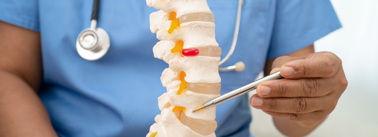 Spondylosis